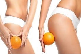 Cellulite loswerden? Was wirklich dagegen hilft!