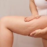 Anti-Cellulite & Firming for the Body 