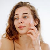 Pflege bei zu Unreinheiten neigender Haut