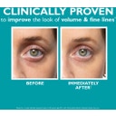 Peptide Skinjection™ Fill + Fix Under-Eye Cream - 15 ml