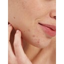 Pai Skincare Salicylic Acid Clarifying Booster - 10 мл