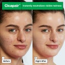 Cicapair™ Tiger Grass Color Correcting Treatment - 15 ml