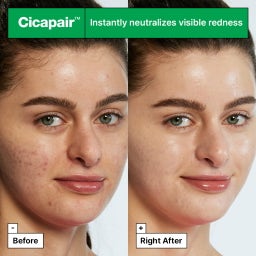Cicapair™ Tiger Grass Color Correcting Treatment - 15 ml
