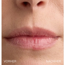 Rosental Organics Lip Plumper - 15 ml