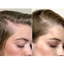 Living Proof Scalp Care Density Serum - 50 ml