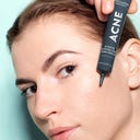 MÁDARA Acne Intense Blemish & Pore Treatment - 20 ml