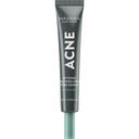 MÁDARA Acne Intense Blemish & Pore Treatment - 20 ml