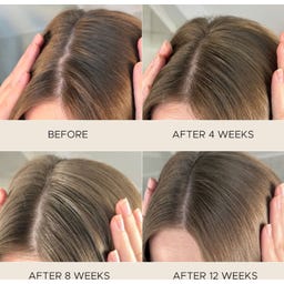 Fortifying Scalp Serum with Amaranth Peptides - 50 ml