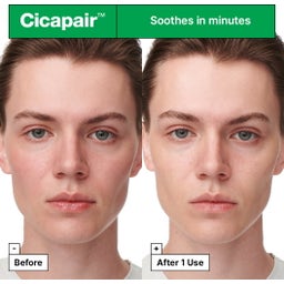 Cicapair™ Intensive Soothing Repair Serum maszk - 1 db