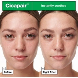 Cicapair™ Intensive Soothing Repair Serum - 30 ml