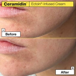 Dr.Jart+ Ceramidin™ Ectoin®-Infused Cream - 50 ml