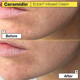 Dr.Jart+ Ceramidin™ Ectoin®-Infused Cream - 50 ml