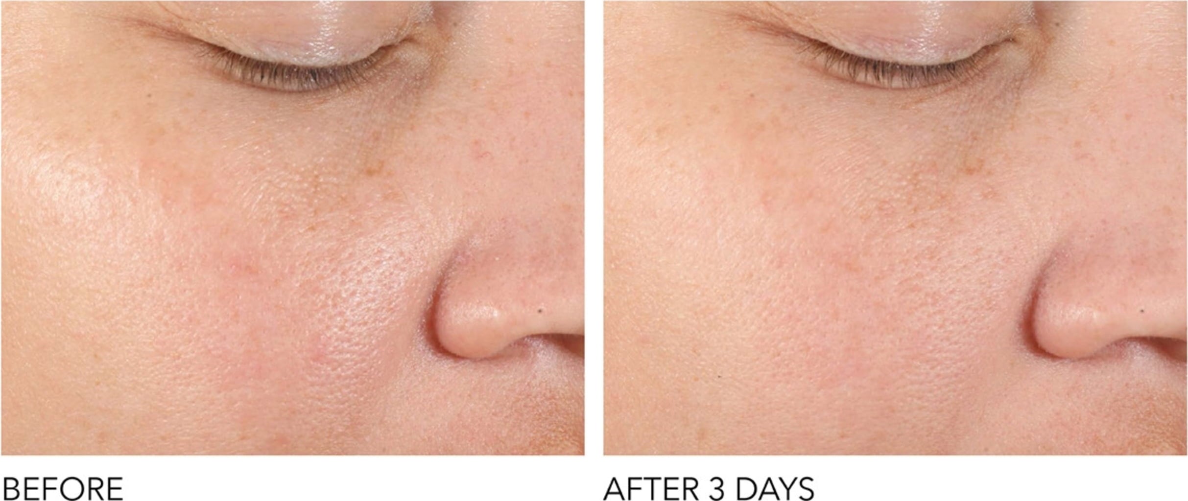 Alpha Beta Pore Perfecting & Refining Serum - 30 ml